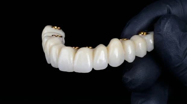 Immediate loading implant treatment 1
